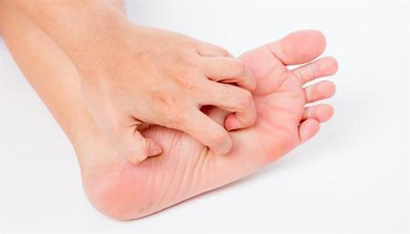 Antipatiche micosi Antipatiche micosi